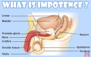 what causes impotence